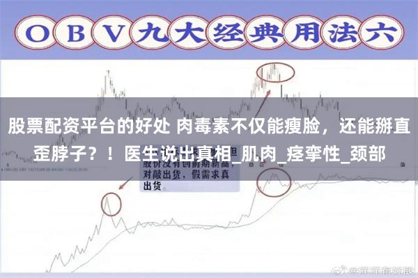 股票配资平台的好处 肉毒素不仅能瘦脸，还能掰直歪脖子？！医生说出真相_肌肉_痉挛性_颈部