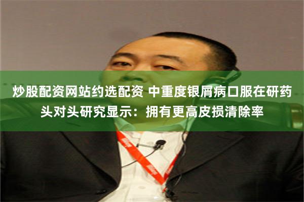 炒股配资网站约选配资 中重度银屑病口服在研药头对头研究显示：拥有更高皮损清除率